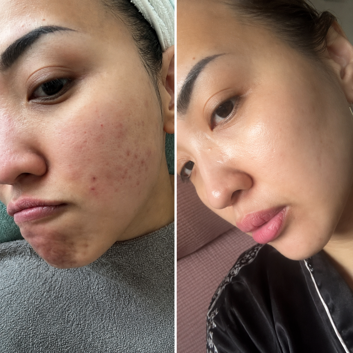 Rosi before and after