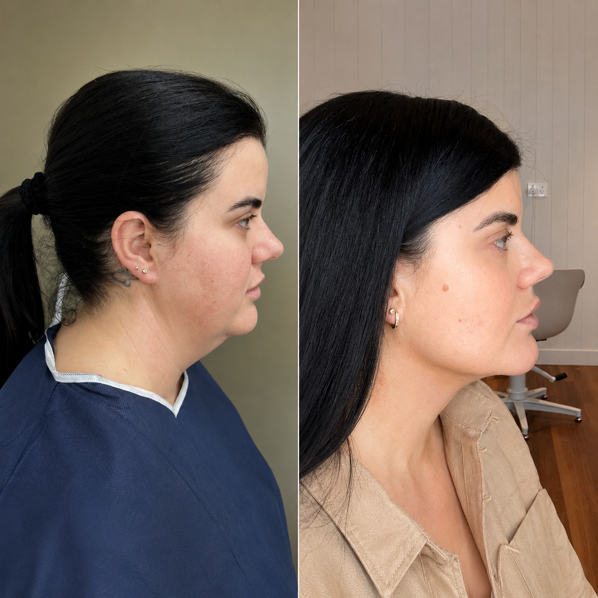 Zambeel before and after
