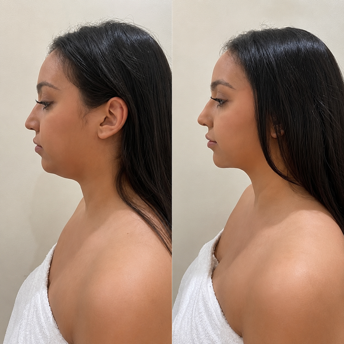 Sophia before and after