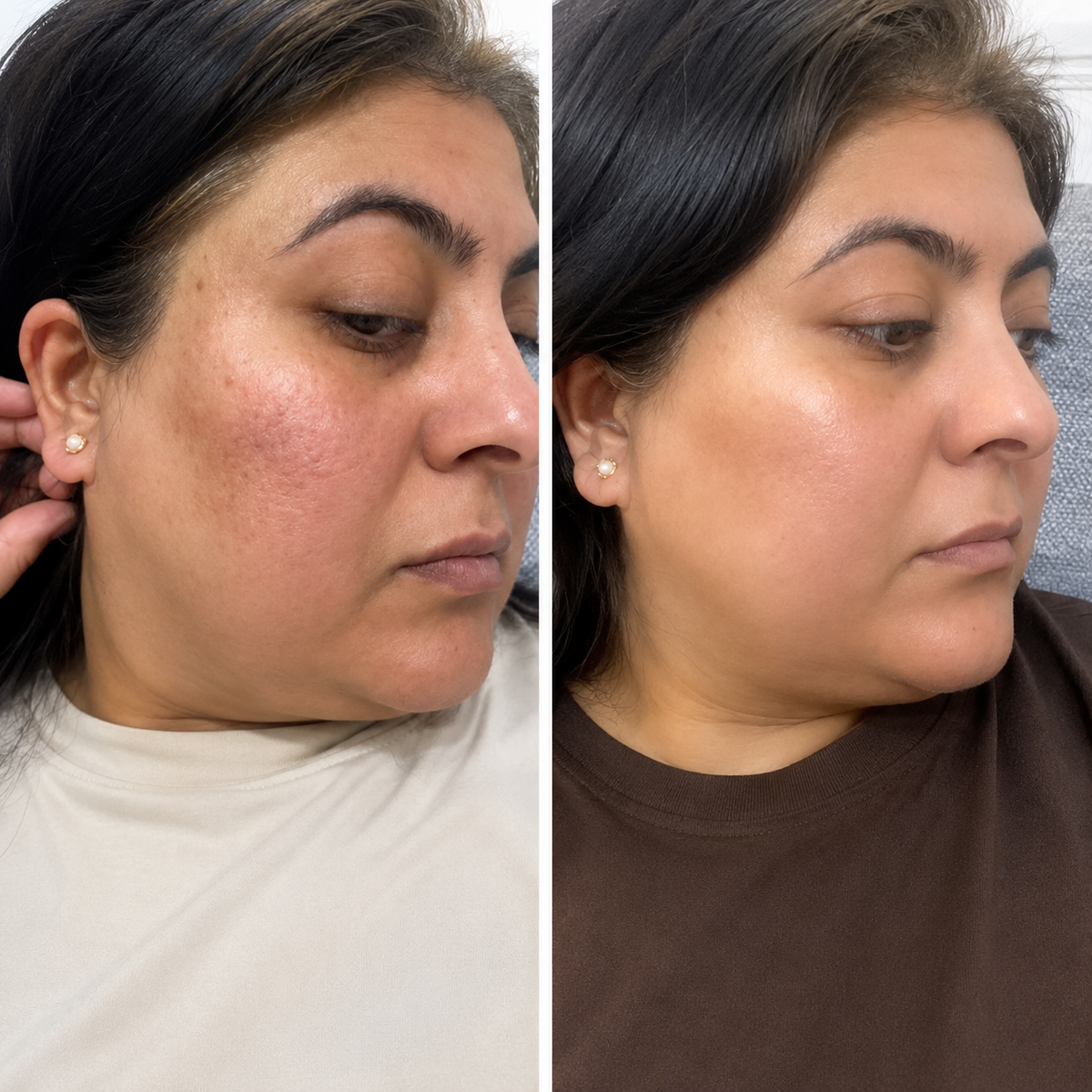 Fatima before and after