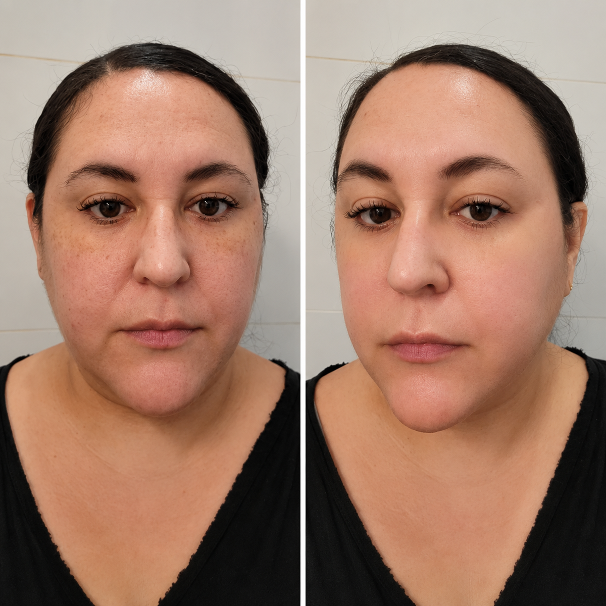 Sara before and after